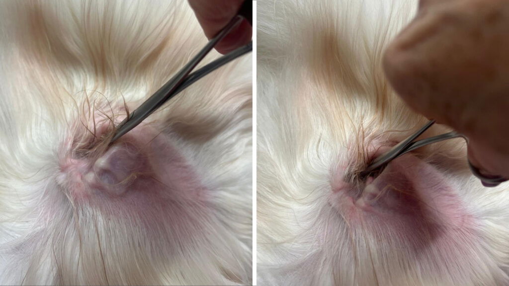 Overtollig haar uit de gehoorgang verwijderen met de kocher